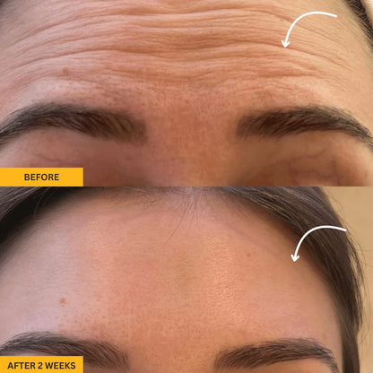 Lymphatic Face Brush