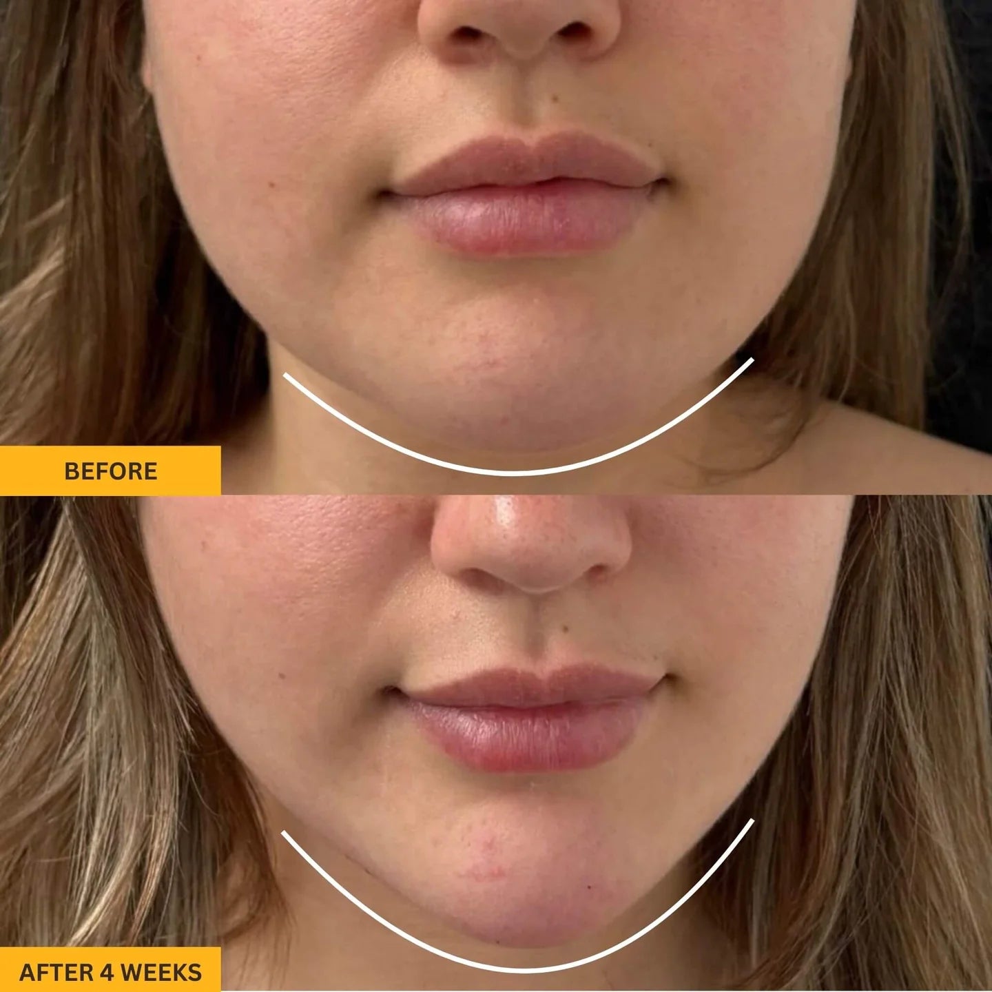 Lymphatic Face Brush